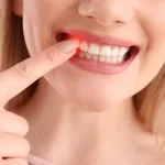 Can gum disease kill you? Woman pointing to red, inflamed gums, indicating early signs of gum disease.